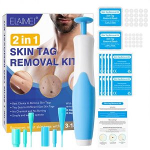 Wart Remover